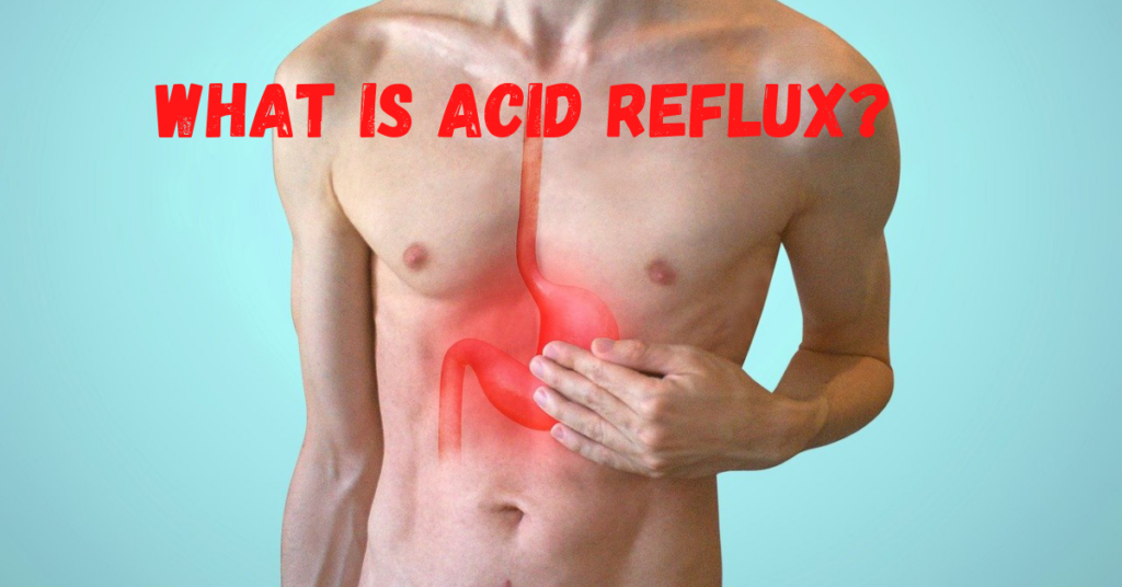 What is Acid Reflux?